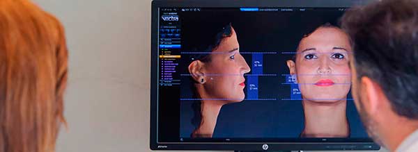 Simulación en 3D del resultado de una cirugía estética de la nariz